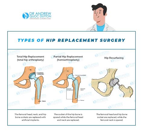 hip and knee surgery greenwich|Total Hip Replacement .